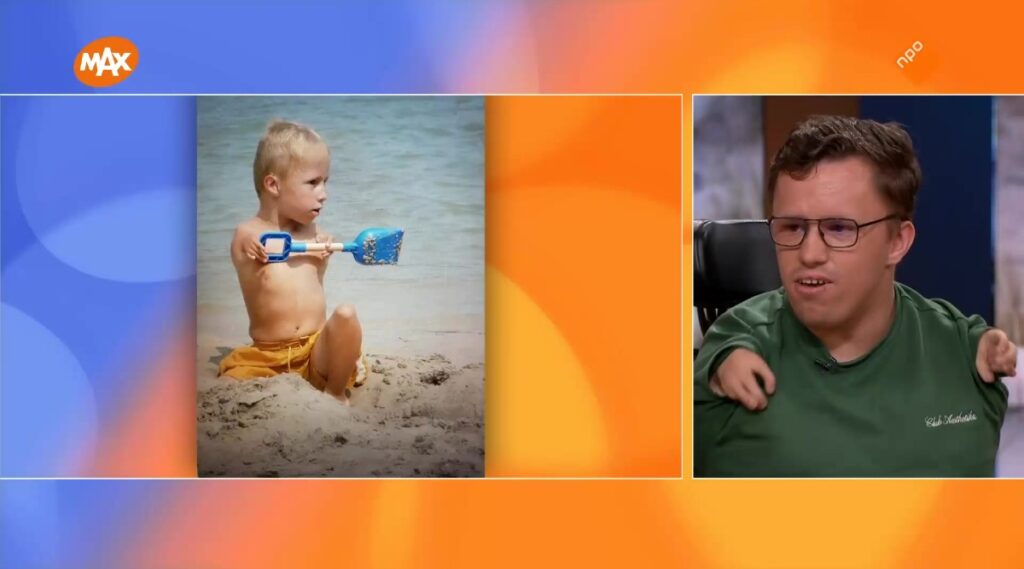 Week van de Toegankelijkheid: Glenn Nugteren over leven met het TAR-syndroom én zelfstandig wonen