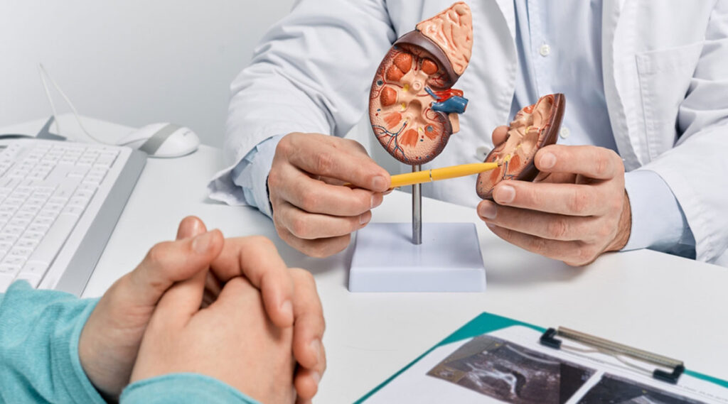 Wat zijn de symptomen van nierstenen, hoe zijn ze te behandelen en zijn