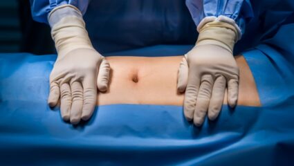 Je ziet iemands lichaam in een operatiekamer en de handen van een arts.