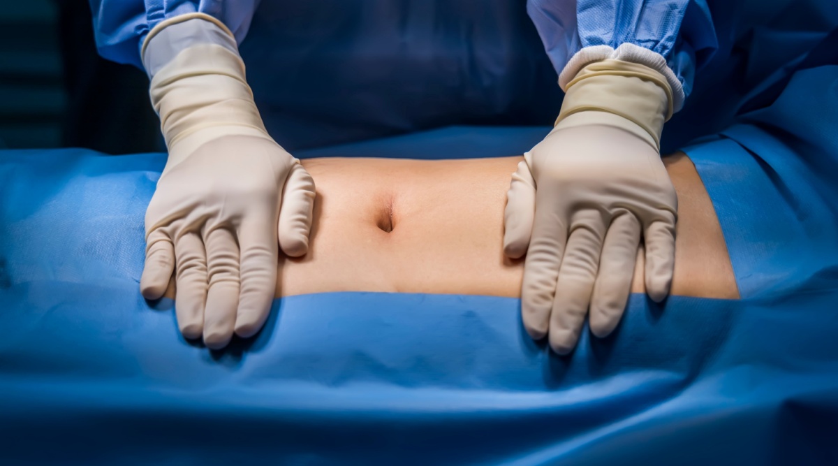 Je ziet iemands lichaam in een operatiekamer en de handen van een arts.